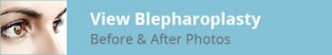 Blepharoplasty Before and After Photos Title Image