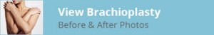 Brachioplasty Before and After Photos Title Image
