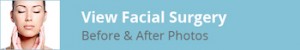 Facial Surgery Before and After Photos Title Image